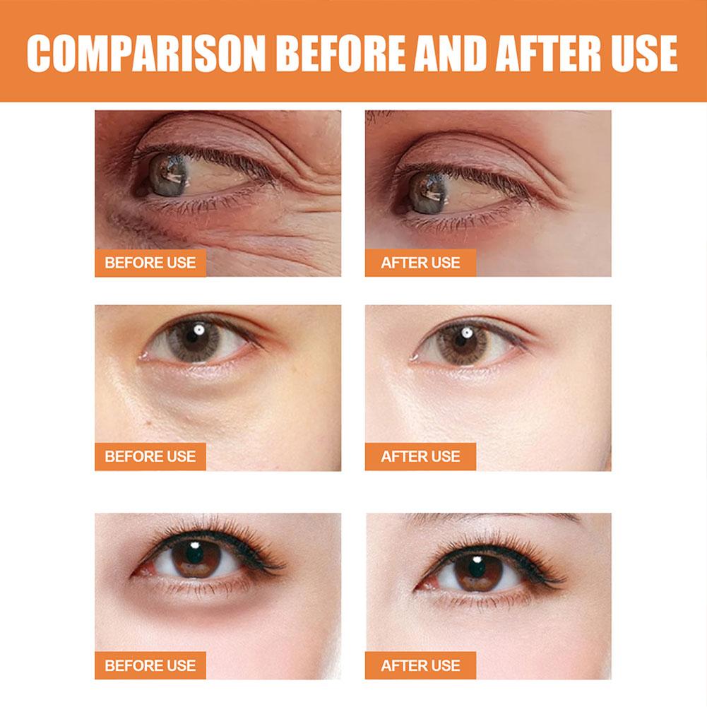 Vitamin C Eye Balm Reduce Fine - Women Bags Under Eyes 评论和价格
